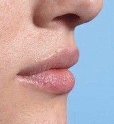 Pflege für trockene Lippen